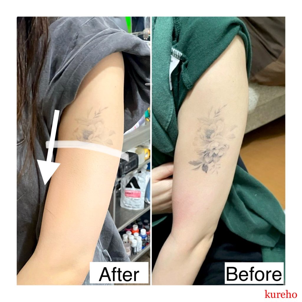 タトゥーカバーアップ（リハーサル）