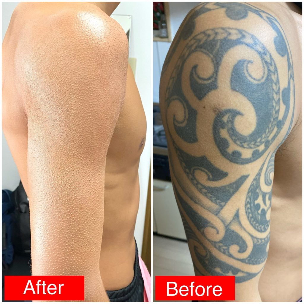 タトゥーカバーアップ